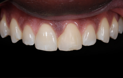 Before